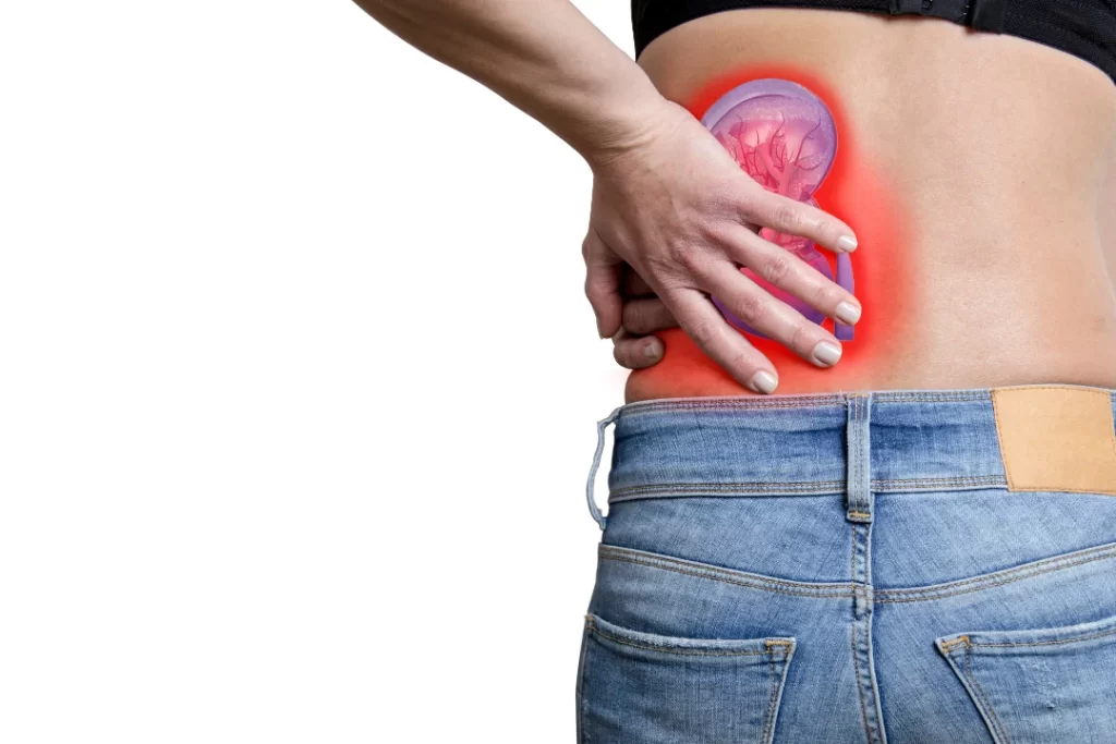concept of Kidney stone pain
