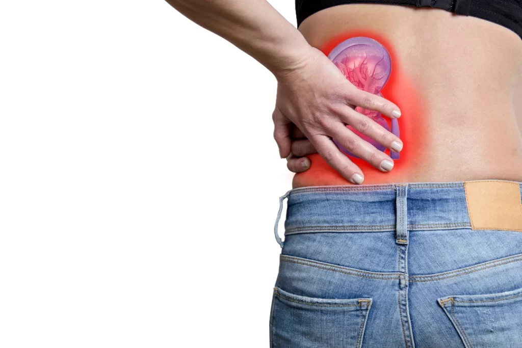 concept of Kidney stone pain 