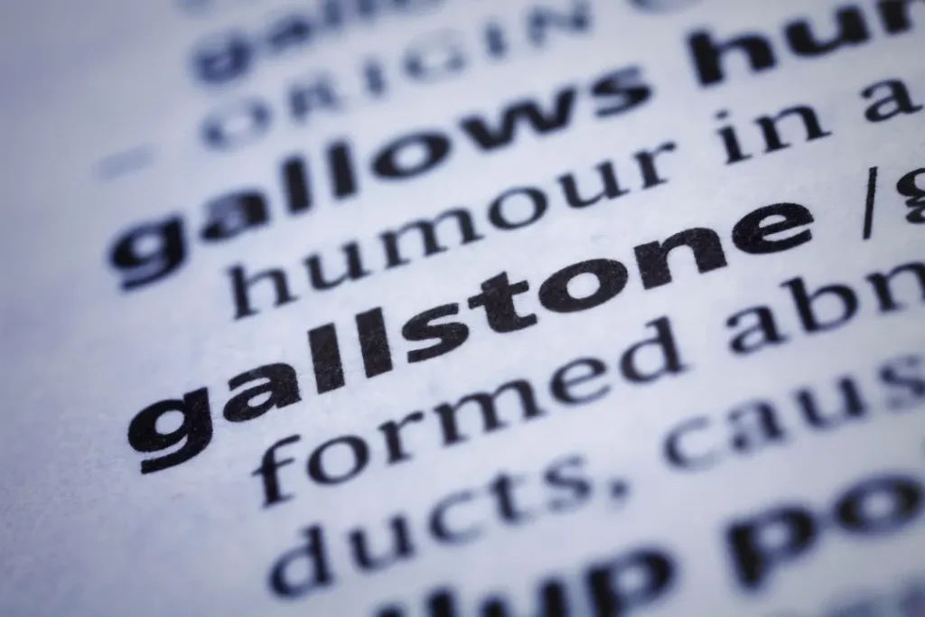 Gallstone is dangerous for health.