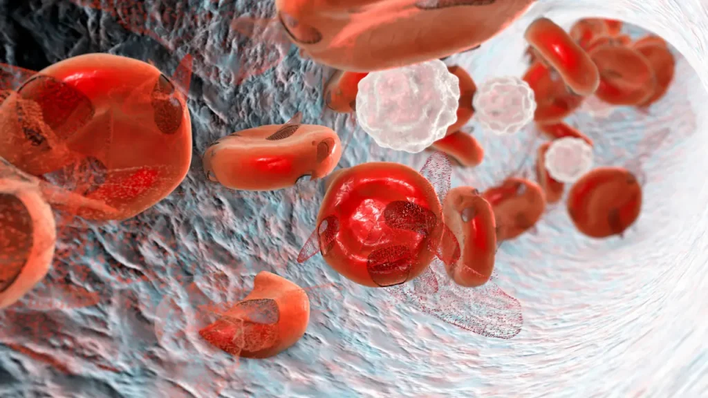 Shortage of red blood cells.